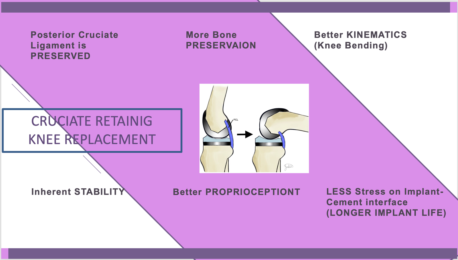 CRUCIATE RETAINING TOTAL KNEE REPLACEMENT